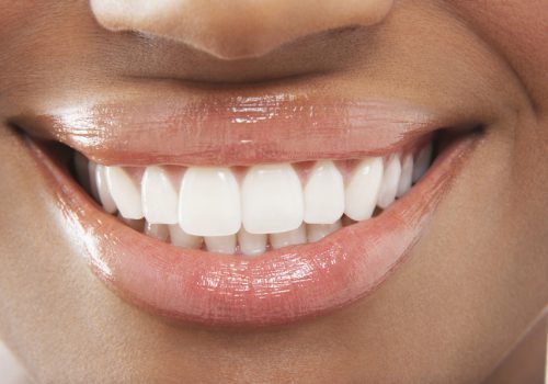 Closeup of woman smiling with perfect white teeth